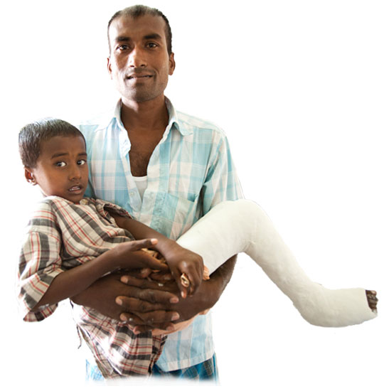 man holding child with leg cast